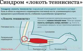 Болят локти после подтягиваний и других упражнений – что делать?