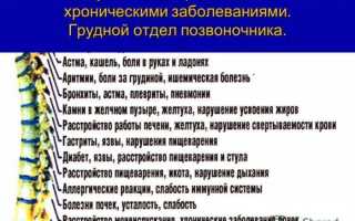 Как диагностировать и лечить защемление нерва в грудном отделе?